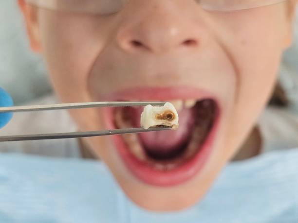 Best Emergency Treatment for Toothache in White House, TN
